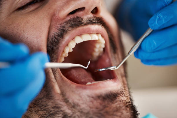Best Dentist for Tooth Abscess  in Sauk City, WI